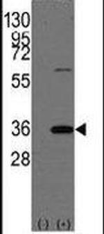 REA Antibody in Western Blot (WB)