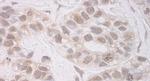 RECQ5 Antibody in Immunohistochemistry (IHC)