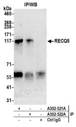 RECQ5 Antibody in Western Blot (WB)