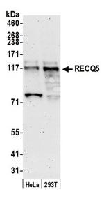 RECQ5 Antibody in Western Blot (WB)
