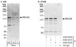 RECQ5 Antibody in Western Blot (WB)