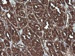 REEP5 Antibody in Immunohistochemistry (Paraffin) (IHC (P))