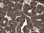 REEP5 Antibody in Immunohistochemistry (Paraffin) (IHC (P))