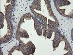 REEP5 Antibody in Immunohistochemistry (Paraffin) (IHC (P))