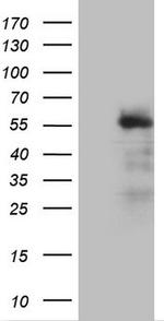 REN Antibody in Western Blot (WB)