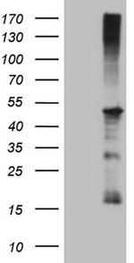 REN Antibody in Western Blot (WB)