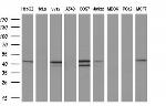 REN Antibody in Western Blot (WB)