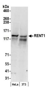 RENT1 Antibody in Western Blot (WB)