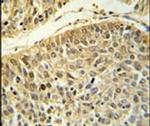 RERE Antibody in Immunohistochemistry (IHC)