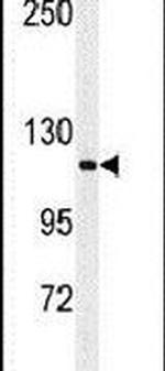 RERE Antibody in Western Blot (WB)