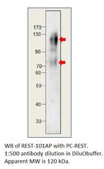 REST/NRSF Antibody in Western Blot (WB)