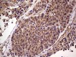 RET Antibody in Immunohistochemistry (Paraffin) (IHC (P))
