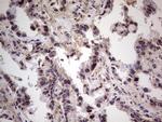 RET Antibody in Immunohistochemistry (Paraffin) (IHC (P))