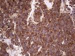 RET Antibody in Immunohistochemistry (Paraffin) (IHC (P))