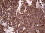 RET Antibody in Immunohistochemistry (Paraffin) (IHC (P))