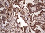 RET Antibody in Immunohistochemistry (Paraffin) (IHC (P))