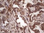 RET Antibody in Immunohistochemistry (Paraffin) (IHC (P))