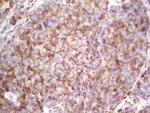 RET Antibody in Immunohistochemistry (Paraffin) (IHC (P))