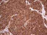 RET Antibody in Immunohistochemistry (Paraffin) (IHC (P))