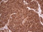 RET Antibody in Immunohistochemistry (Paraffin) (IHC (P))
