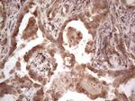 RET Antibody in Immunohistochemistry (Paraffin) (IHC (P))