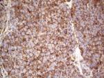 RET Antibody in Immunohistochemistry (Paraffin) (IHC (P))
