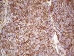 RET Antibody in Immunohistochemistry (Paraffin) (IHC (P))