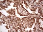 RET Antibody in Immunohistochemistry (Paraffin) (IHC (P))