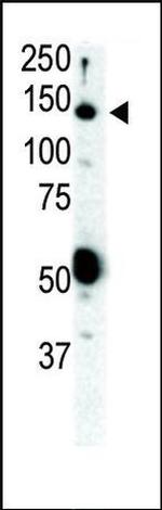 RET Antibody in Western Blot (WB)