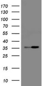 RFC2 Antibody in Western Blot (WB)