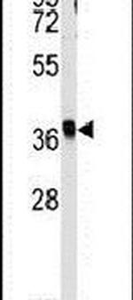 RFC2 Antibody in Western Blot (WB)