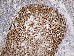 RFC3 Antibody in Immunohistochemistry (Paraffin) (IHC (P))