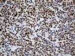 RFC3 Antibody in Immunohistochemistry (Paraffin) (IHC (P))
