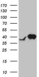 RFC3 Antibody in Western Blot (WB)