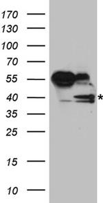 RFC3 Antibody in Western Blot (WB)