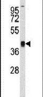 RFC3 Antibody in Western Blot (WB)