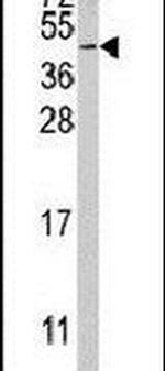 RFC5 Antibody in Western Blot (WB)