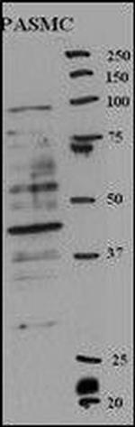 RFC5 Antibody in Western Blot (WB)