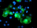 RFPL3 Antibody in Immunocytochemistry (ICC/IF)