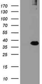 RFPL3 Antibody in Western Blot (WB)