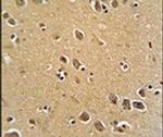 RFT1 Antibody in Immunohistochemistry (IHC)