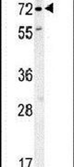RFT1 Antibody in Western Blot (WB)