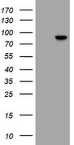 RFX3 Antibody in Western Blot (WB)