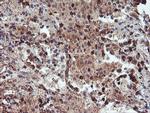RFXANK Antibody in Immunohistochemistry (Paraffin) (IHC (P))