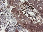 RFXANK Antibody in Immunohistochemistry (Paraffin) (IHC (P))