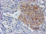 RFXANK Antibody in Immunohistochemistry (Paraffin) (IHC (P))