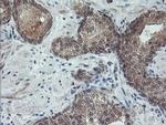 RFXANK Antibody in Immunohistochemistry (Paraffin) (IHC (P))