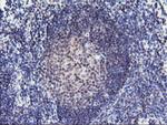RFXANK Antibody in Immunohistochemistry (Paraffin) (IHC (P))