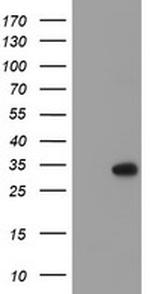 RFXANK Antibody in Western Blot (WB)