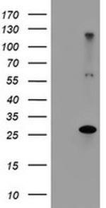 RFXANK Antibody in Western Blot (WB)